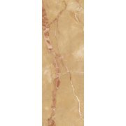 Металлическая съемная решетка для мойки Ideal Standard BRENTA P, хром, J3494AA